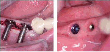 Image de diapositive
