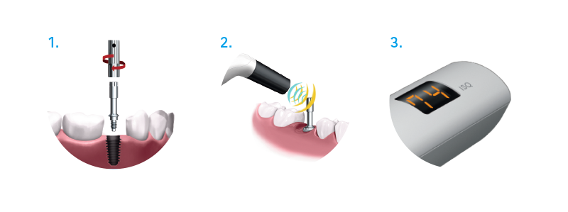 Mesure osthéo-intégration OSSEO 100 - Nsk