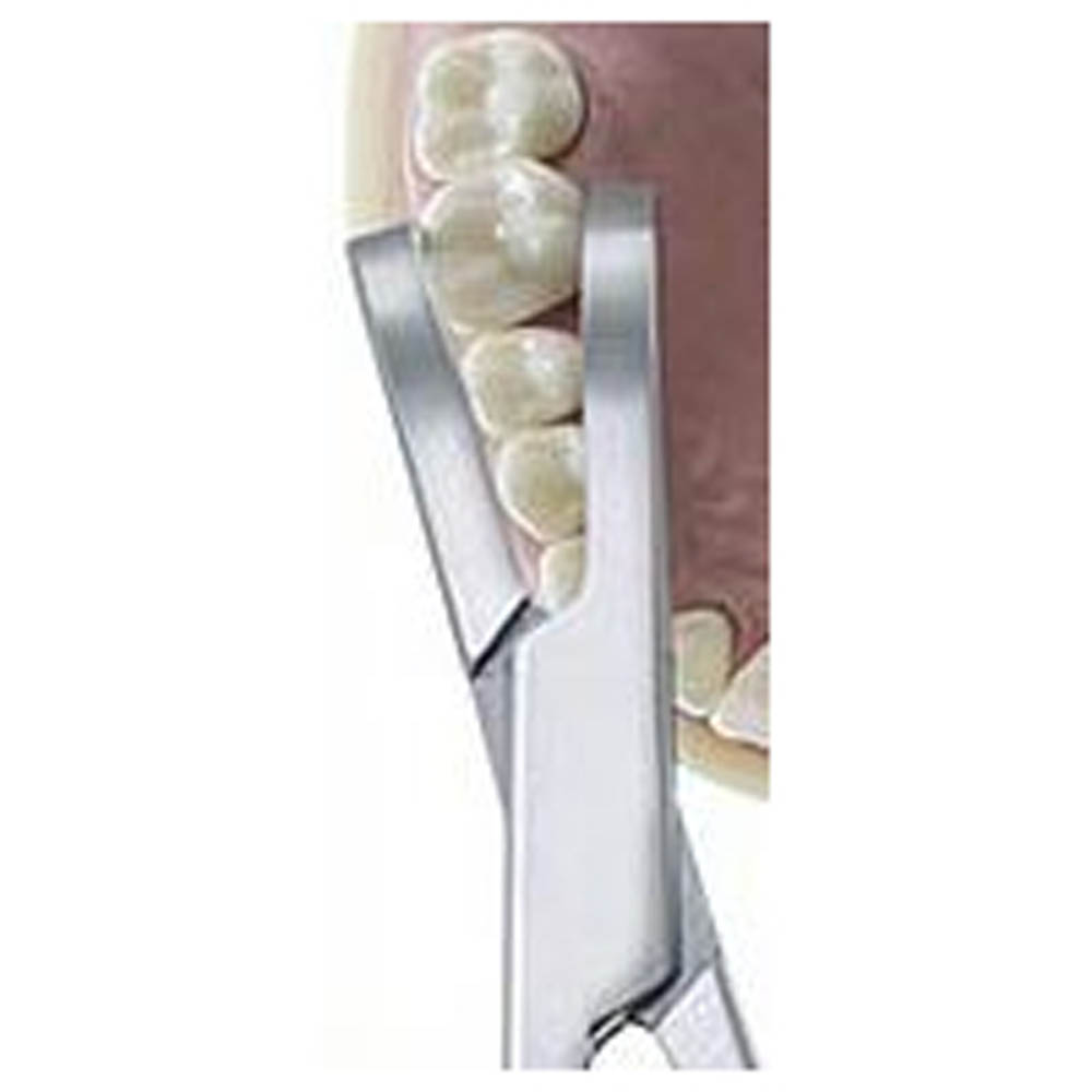 CROWN PLIER WYNMAN (362271) CORICAMA  - Delynov