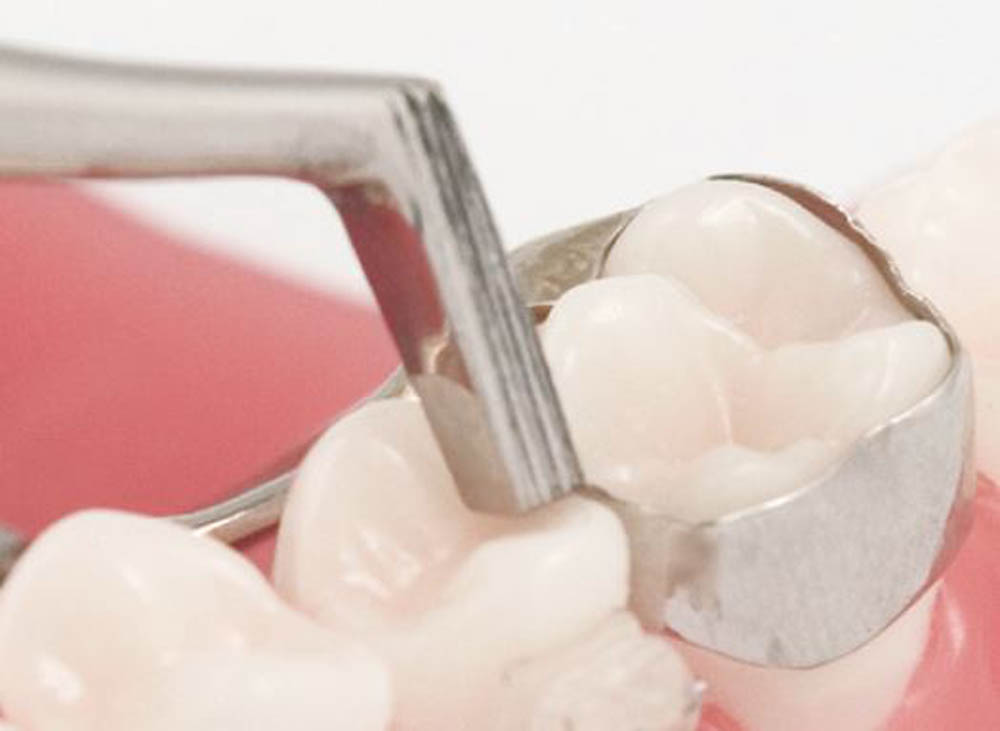 Band pusher Mershon mm150 (762350) Coricama - Mershon mm150 Band Pusher (762350) by Coricama
Delynov - Delynov 
These are products for dental surgery exclusively.