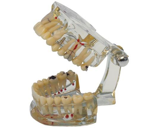 Studienmodell Transparent Plus 355 640 - Hager&Werken - Delynov
