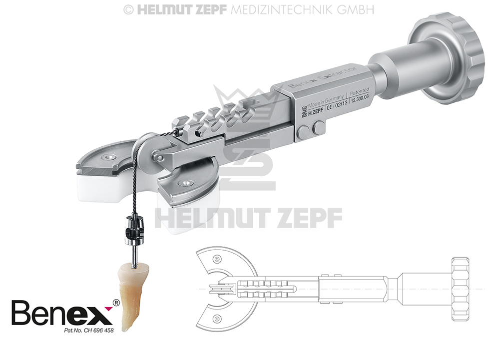 EXTRACTEUR BENEX III NOUVEAU- Helmut Zepf (12.300.08) - Delynov