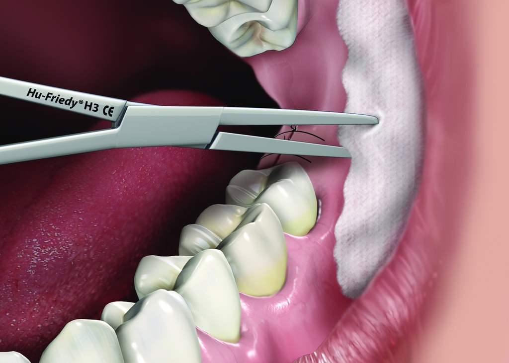 Pince hémostatique Halsted-Mosquito #3 12cm courbée - Hu-Friedy - Delynov