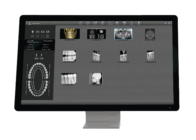 Acteon - Delynov - Suite d'imagerie 3D - Version 4.2 - Application (W1000021)