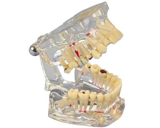 [355642] Studienmodell Transparent De Luxe (355 642) - Hager&Werken - Delynov